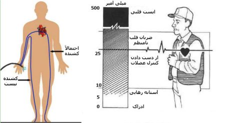 تأثیر برق گرفتگی بر روی دستگاه عصبی